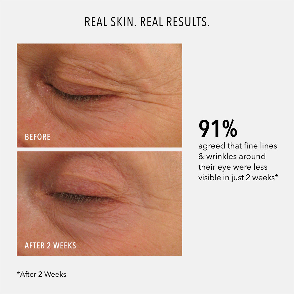 Eye Cream Mysteries Unraveled