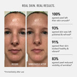 Polish & Plump Face Peel