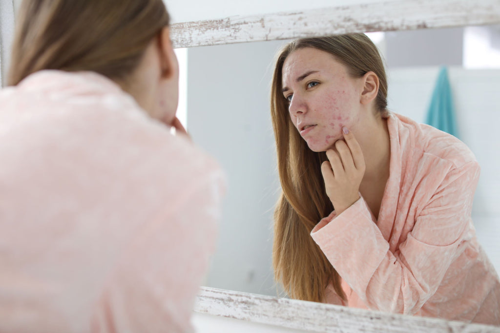 8 things you're doing wrong when treating acne