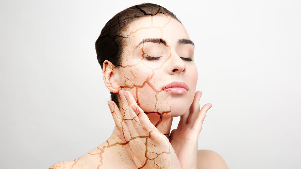 Dry Vs. Dehydrated Skin: How To Spot The Difference