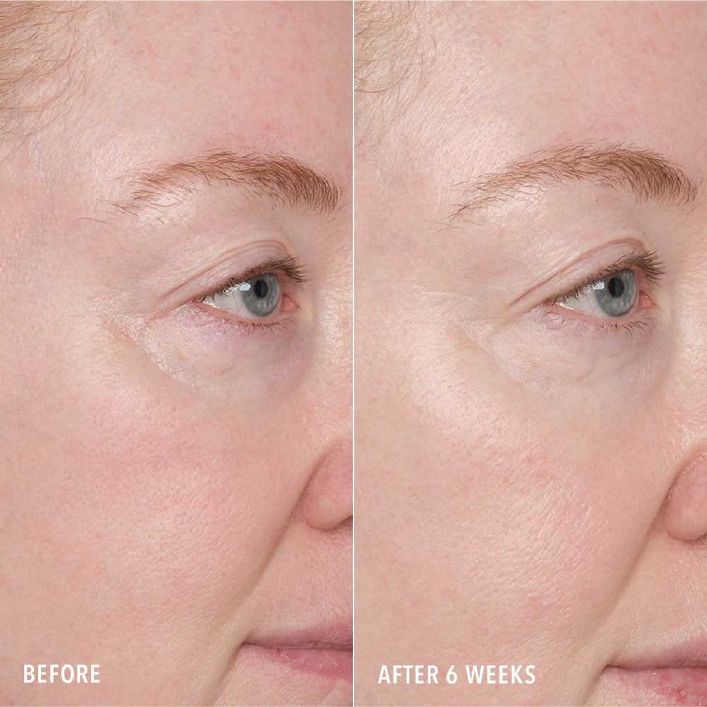 Resurface and Repair Peptide Pads