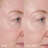 Resurface and Repair Peptide Pads