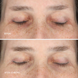 InnerDerm Rx Refill