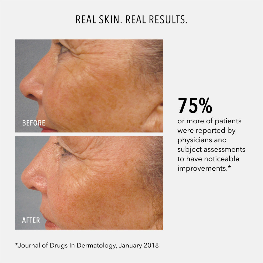 Travel-Size LumaPro-C Face Serum