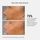 Travel-Size LumaPro-C Face Serum