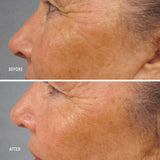 Travel-Size LumaPro-C Face Serum