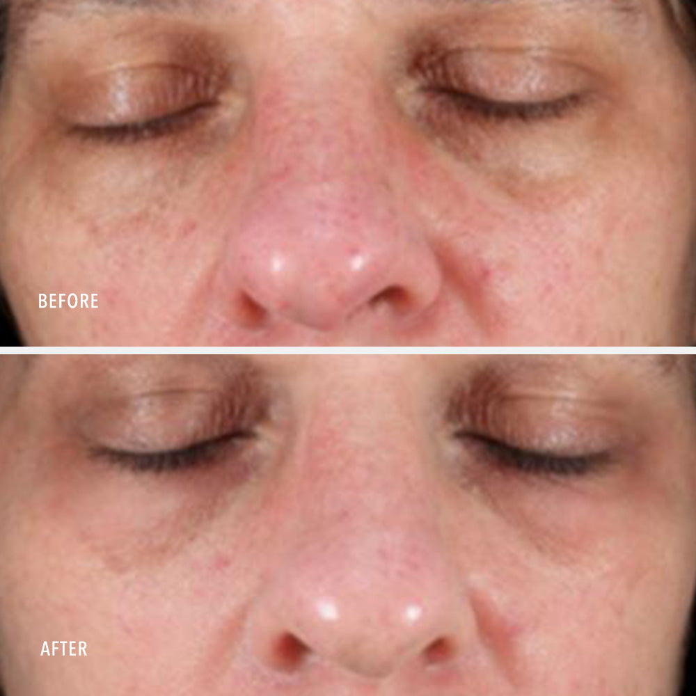 Collagen ReActivate PM
