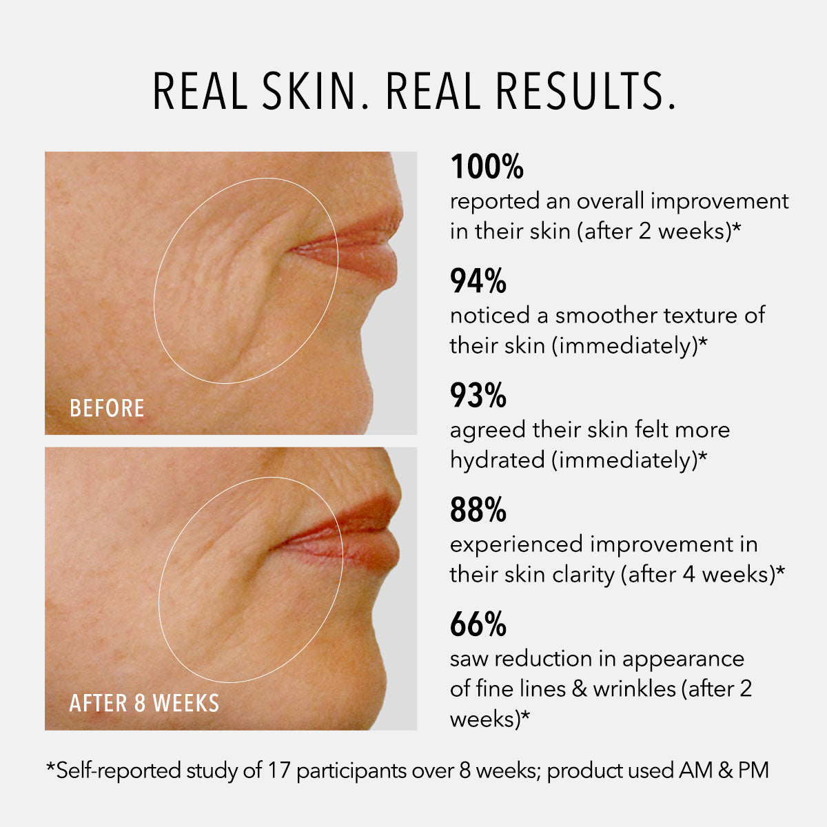 HydroPeptide Daily Drench before and after and statistical results