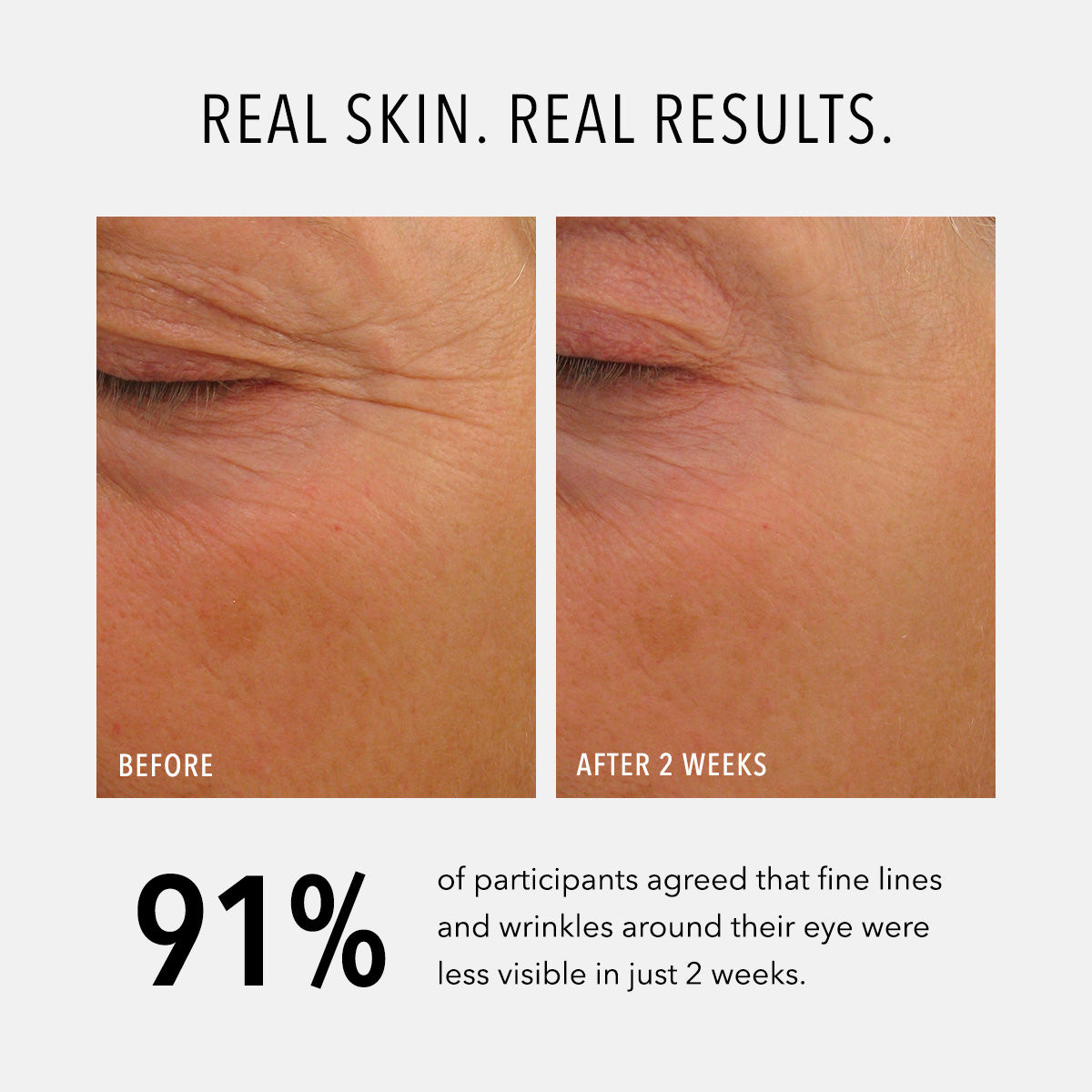 HydroPeptide Eye Authority eye cream before and after image