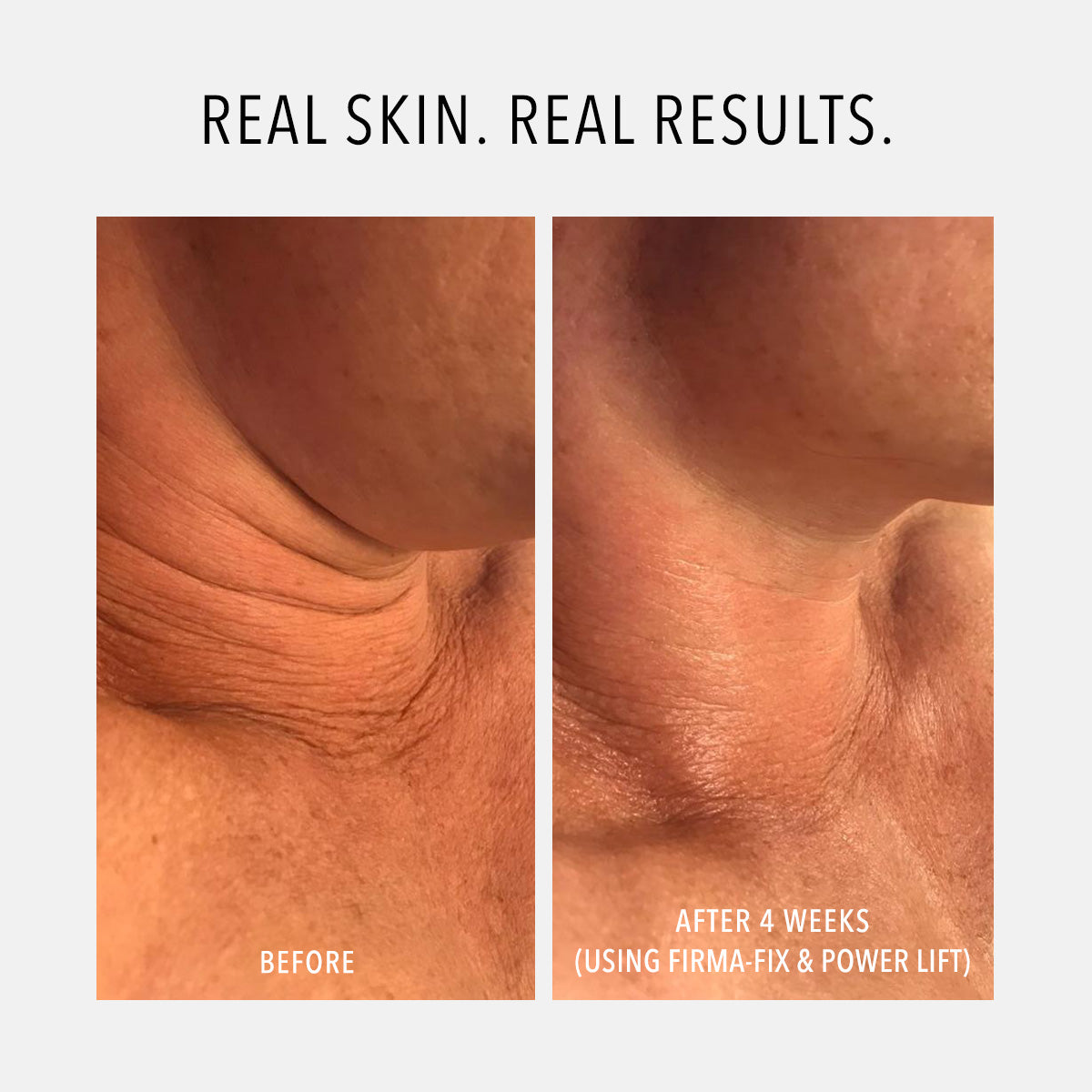 Before and after comparison of skin texture using HydroPeptide Firma-Fix Nectar Serum & Power Lift treatment.