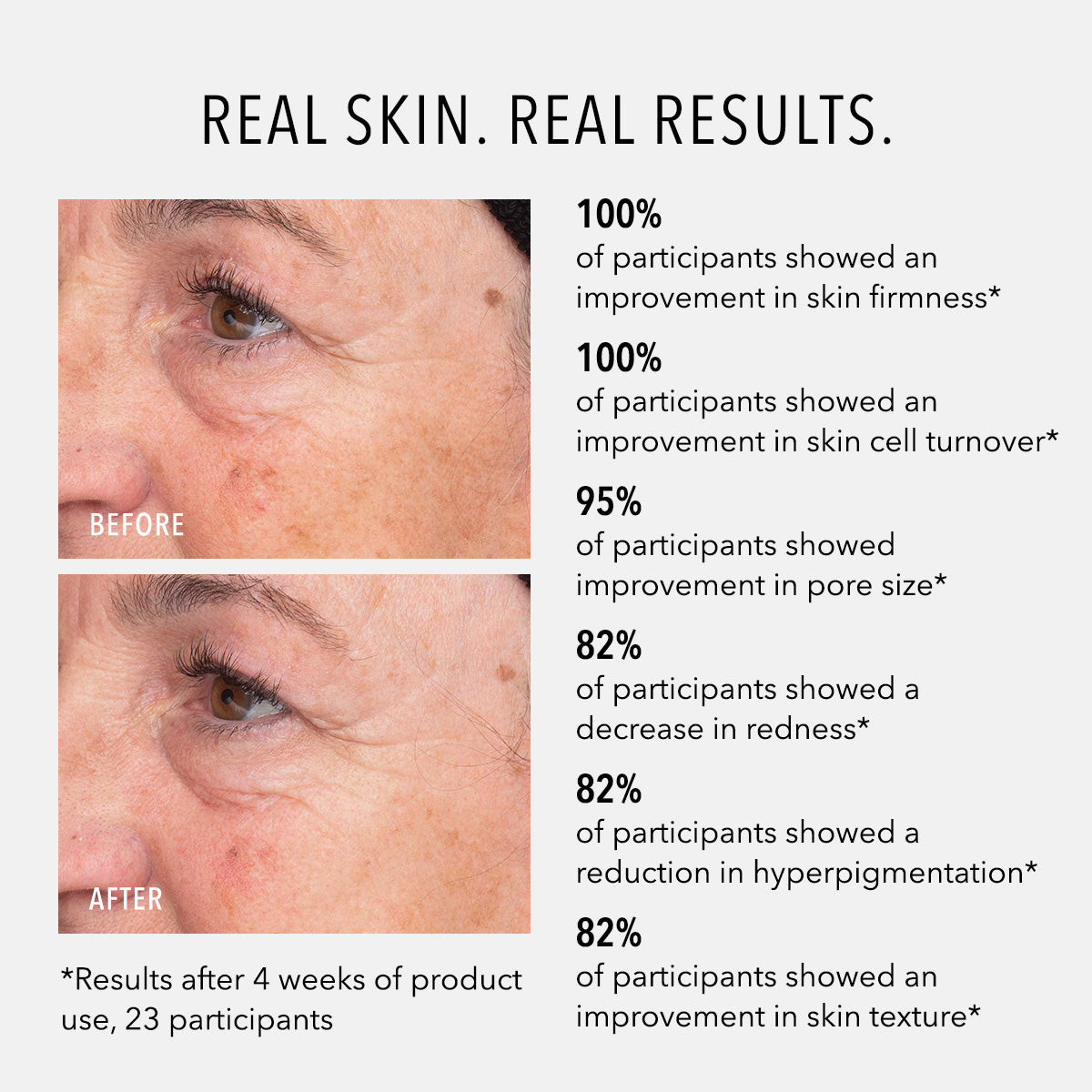 HydroPeptide Liquid Resurfacing Solution before and after with statistical results