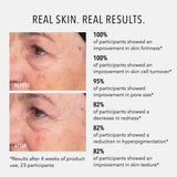 Liquid Resurfacing Solution