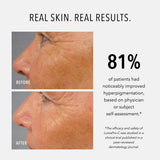 Travel-Size LumaPro-C Face Serum