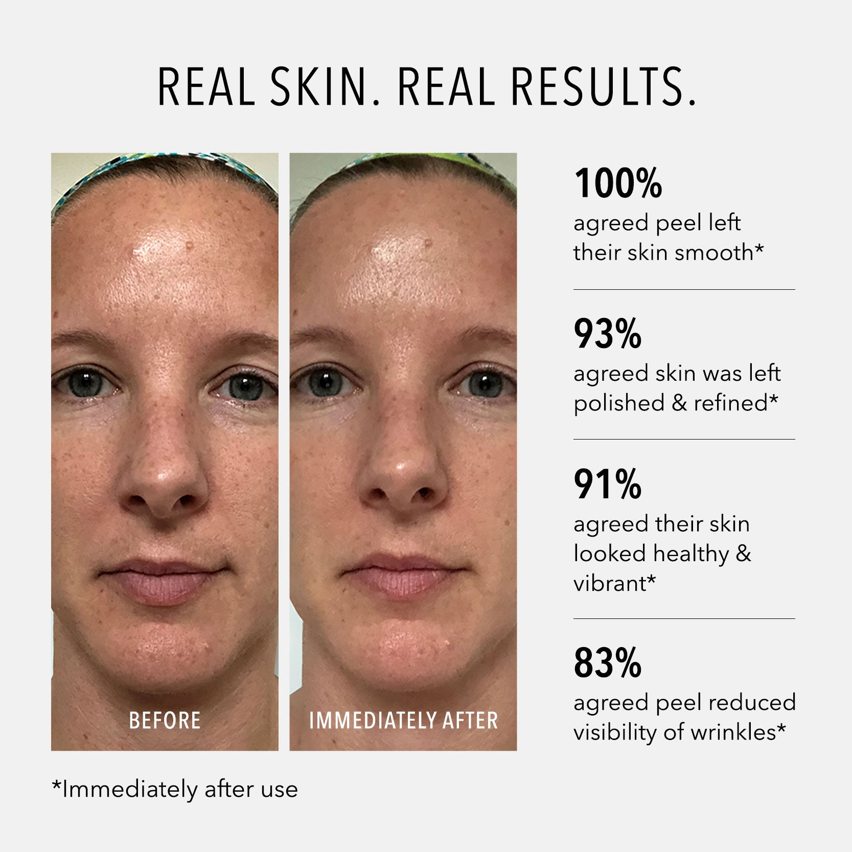 HydroPeptide Polish and Plump Peel before and after and results statistics
