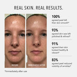 Polish & Plump Face Peel