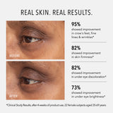 Retinol Eye Renewal