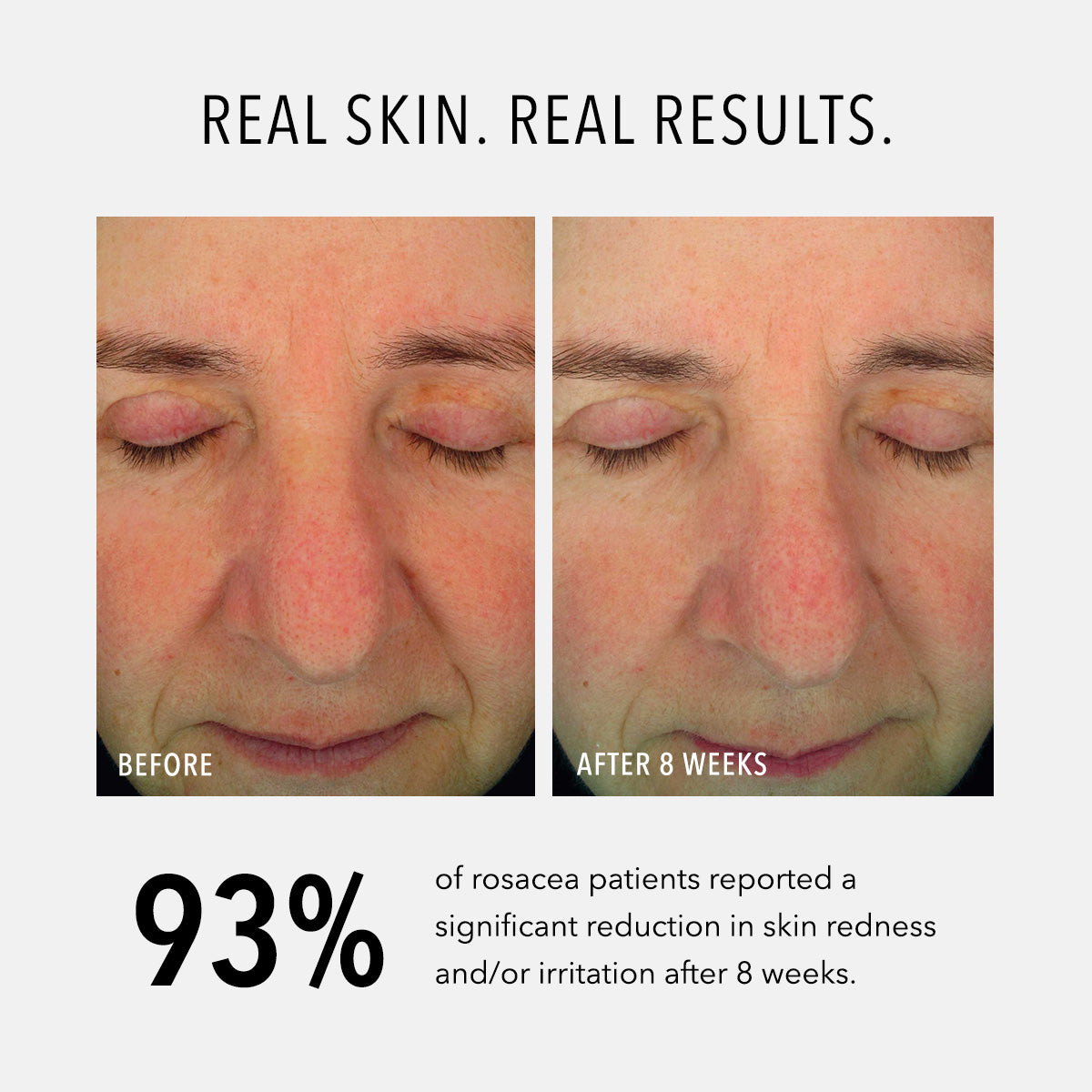 HydroPeptide Soothing Serum before and after with results statistics