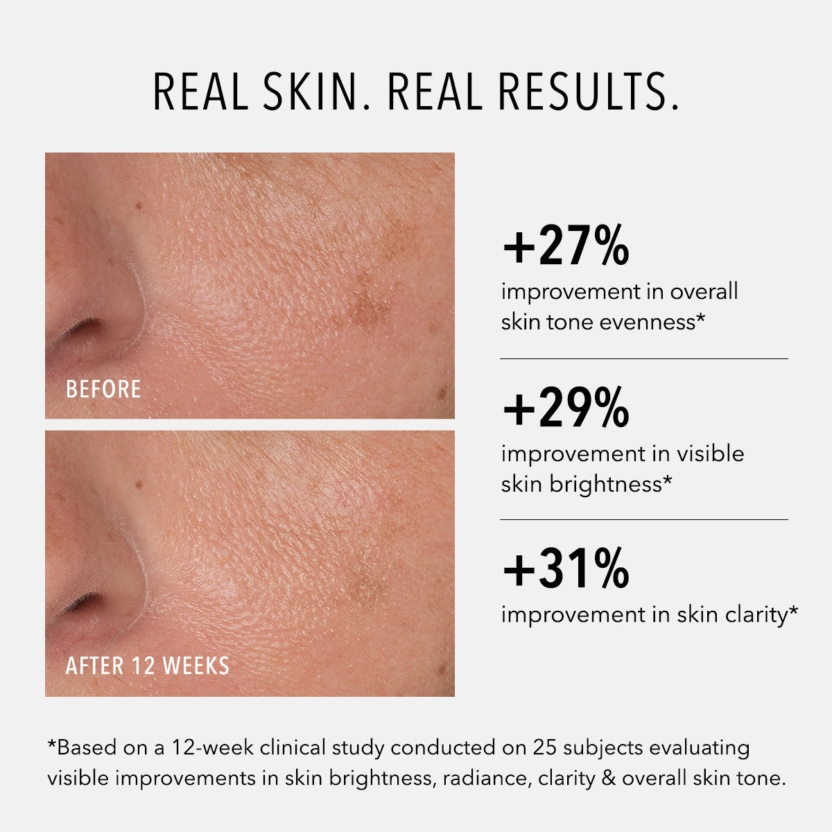 Before-and-after skin comparison graphic showing a close-up of a nose and cheek with text claiming +27% overall skin tone evenness, +29% visible skin brightness, and +31% skin clarity after 12 weeks.