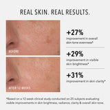 Before-and-after skin comparison graphic showing a close-up of a nose and cheek with text claiming +27% overall skin tone evenness, +29% visible skin brightness, and +31% skin clarity after 12 weeks.